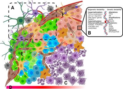 Glioblastoma and the search for non-hypothesis driven combination therapeutics in academia